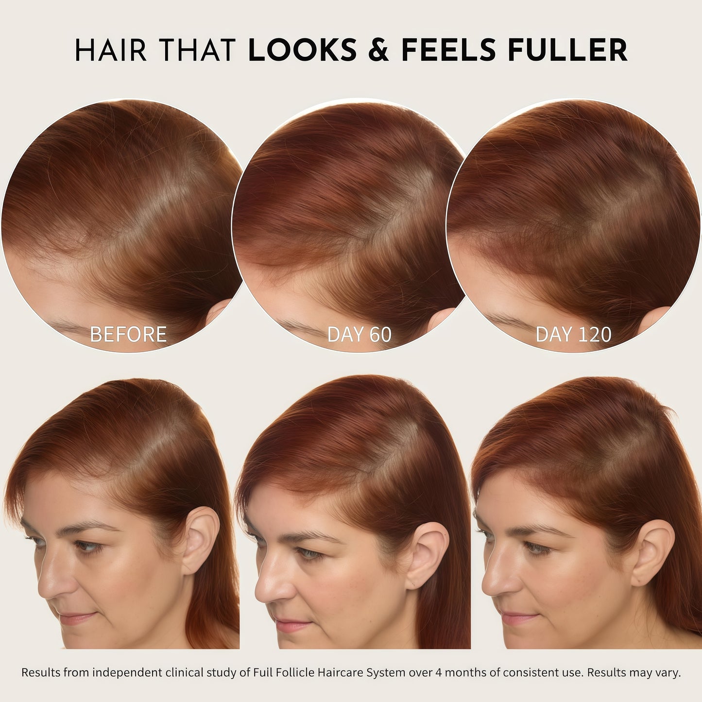 Full Follicle Advanced Scalp Serum