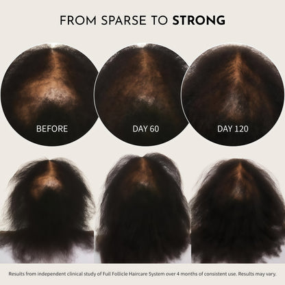 Full Follicle Advanced Scalp Serum